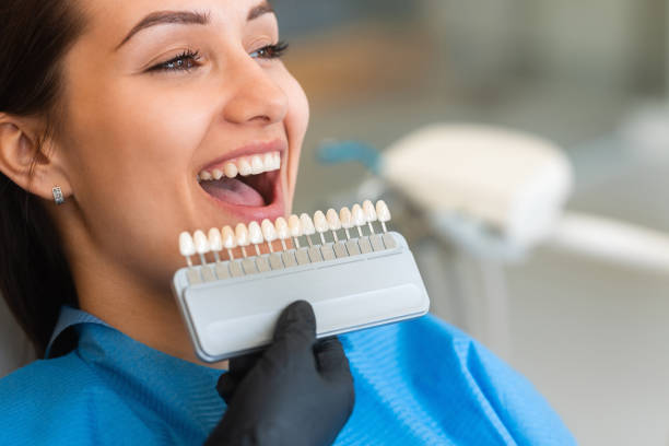 Dental fillings