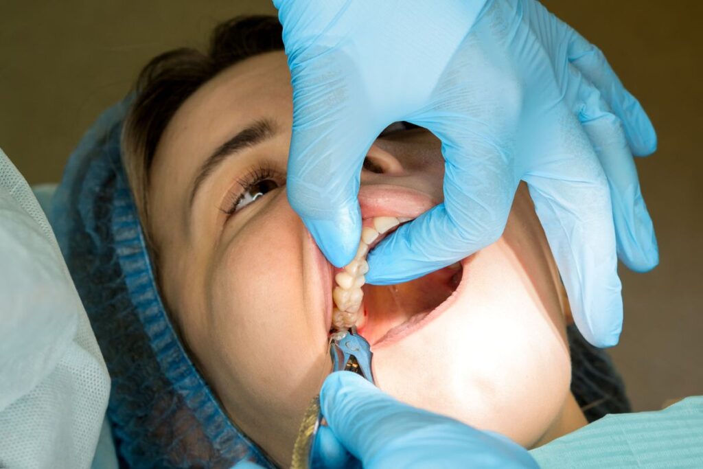Tooth Bridges